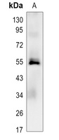 Caspase 8 Rabbit Monoclonal Antibody