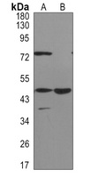 ACOX1 Rabbit Monoclonal Antibody