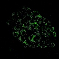 ACOX1 Rabbit Monoclonal Antibody
