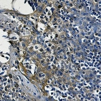 Alpha-enolase Rabbit Monoclonal Antibody