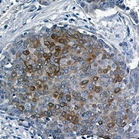 4EBP1 (Phospho-T46) Rabbit Monoclonal Antibody