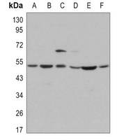 JNK1 Rabbit Monoclonal Antibody