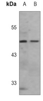 Caspase 9 Rabbit Monoclonal Antibody