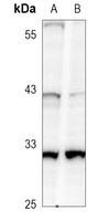 Caspase 3 Rabbit Monoclonal Antibody