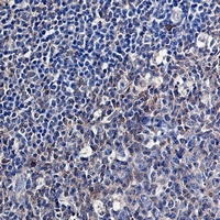 Caspase 3 Rabbit Monoclonal Antibody