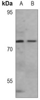 PKR Rabbit Monoclonal Antibody