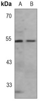 GFAP Rabbit Monoclonal Antibody