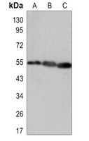 Vimentin Rabbit Monoclonal Antibody