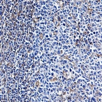 Vimentin Rabbit Monoclonal Antibody