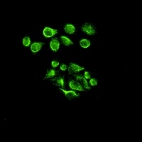 Vimentin Rabbit Monoclonal Antibody