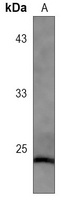 Caveolin 1 Rabbit Monoclonal Antibody