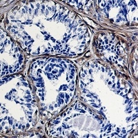 Caveolin 1 Rabbit Monoclonal Antibody