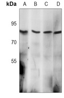 MLH1 Rabbit Monoclonal Antibody