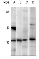 CDK2 Rabbit Monoclonal Antibody