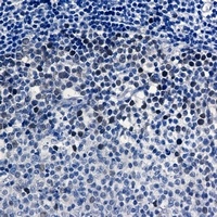 CDK2 Rabbit Monoclonal Antibody