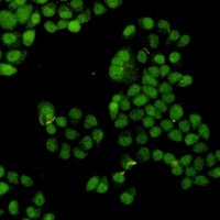 CDK2 Rabbit Monoclonal Antibody