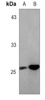 BCL2 Rabbit Monoclonal Antibody