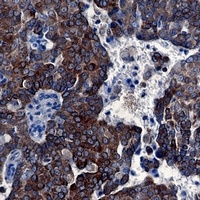 BCL2 Rabbit Monoclonal Antibody