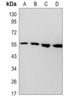 AKT Rabbit Monoclonal Antibody