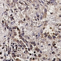 AKT Rabbit Monoclonal Antibody