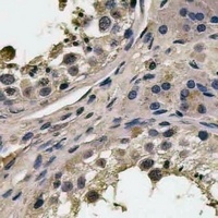 FAM3A Rabbit Polyclonal Antibody