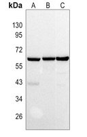 TRAF6 Rabbit Polyclonal Antibody