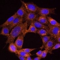 TRAF6 Rabbit Polyclonal Antibody