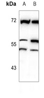 MATK Rabbit Polyclonal Antibody