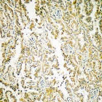 MATK Rabbit Polyclonal Antibody