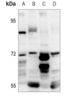 CD126 Rabbit Polyclonal Antibody