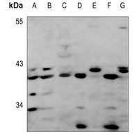 GPR92 Rabbit Polyclonal Antibody