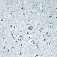 GPR92 Rabbit Polyclonal Antibody