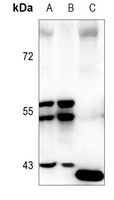 CCR10 Rabbit Polyclonal Antibody