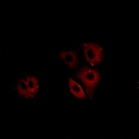 CCR10 Rabbit Polyclonal Antibody