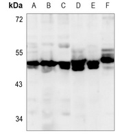 GPR152 Rabbit Polyclonal Antibody