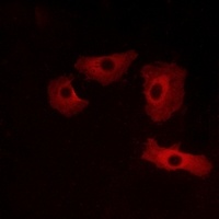 GPR152 Rabbit Polyclonal Antibody