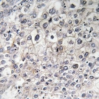 CCR10 Rabbit Polyclonal Antibody