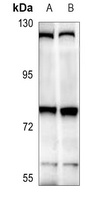 THOC5 Rabbit Polyclonal Antibody