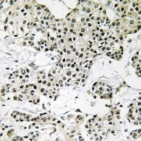 THOC5 Rabbit Polyclonal Antibody