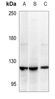 UPF1 Rabbit Polyclonal Antibody