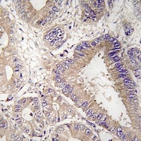 UPF1 Rabbit Polyclonal Antibody