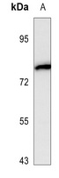 NOX5 Rabbit Polyclonal Antibody