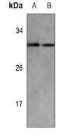 KDELR3 Rabbit Polyclonal Antibody