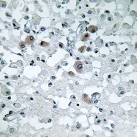 KDELR3 Rabbit Polyclonal Antibody