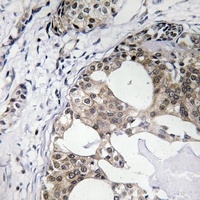 RPS25 Rabbit Polyclonal Antibody