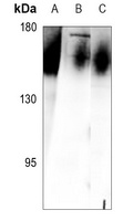 IL-17RA Rabbit Polyclonal Antibody