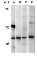 CARD10 Rabbit Polyclonal Antibody