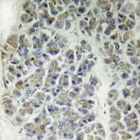 CARD10 Rabbit Polyclonal Antibody