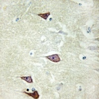 Collagen 25 alpha 1 Rabbit Polyclonal Antibody