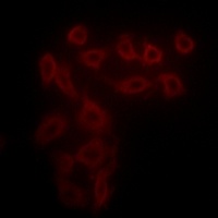 Collagen 25 alpha 1 Rabbit Polyclonal Antibody